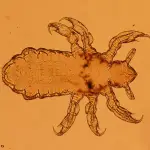 Imagen de una larva de piojo, vista por un microscopio