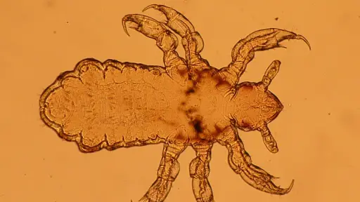 Imagen de una larva de piojo, vista por un microscopio